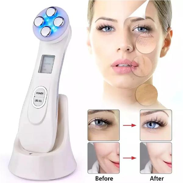 Masajeador Facial de Mesoterapia por Electroporación